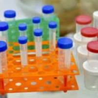 副溶血性弧菌核酸检测试剂盒（恒温荧光法）