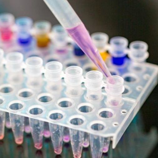 肠出血性大肠杆菌O157核酸检测试剂盒(PCR-荧光探法)