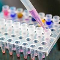 沙门氏菌核酸检测试剂盒（带内参，PCR-荧光探针法）