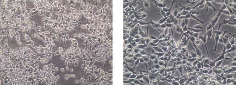 细胞培养基本知识-细胞形态