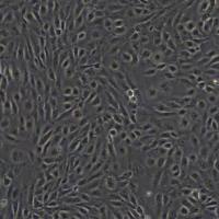 人脐静脉内皮细胞HUVEC