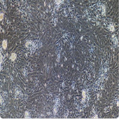 人肾癌Wilms,G-401细胞