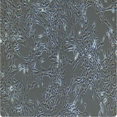 人喉癌细胞系,Hep-2细胞