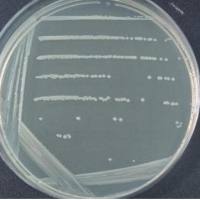 Lachnospiraceae bacterium