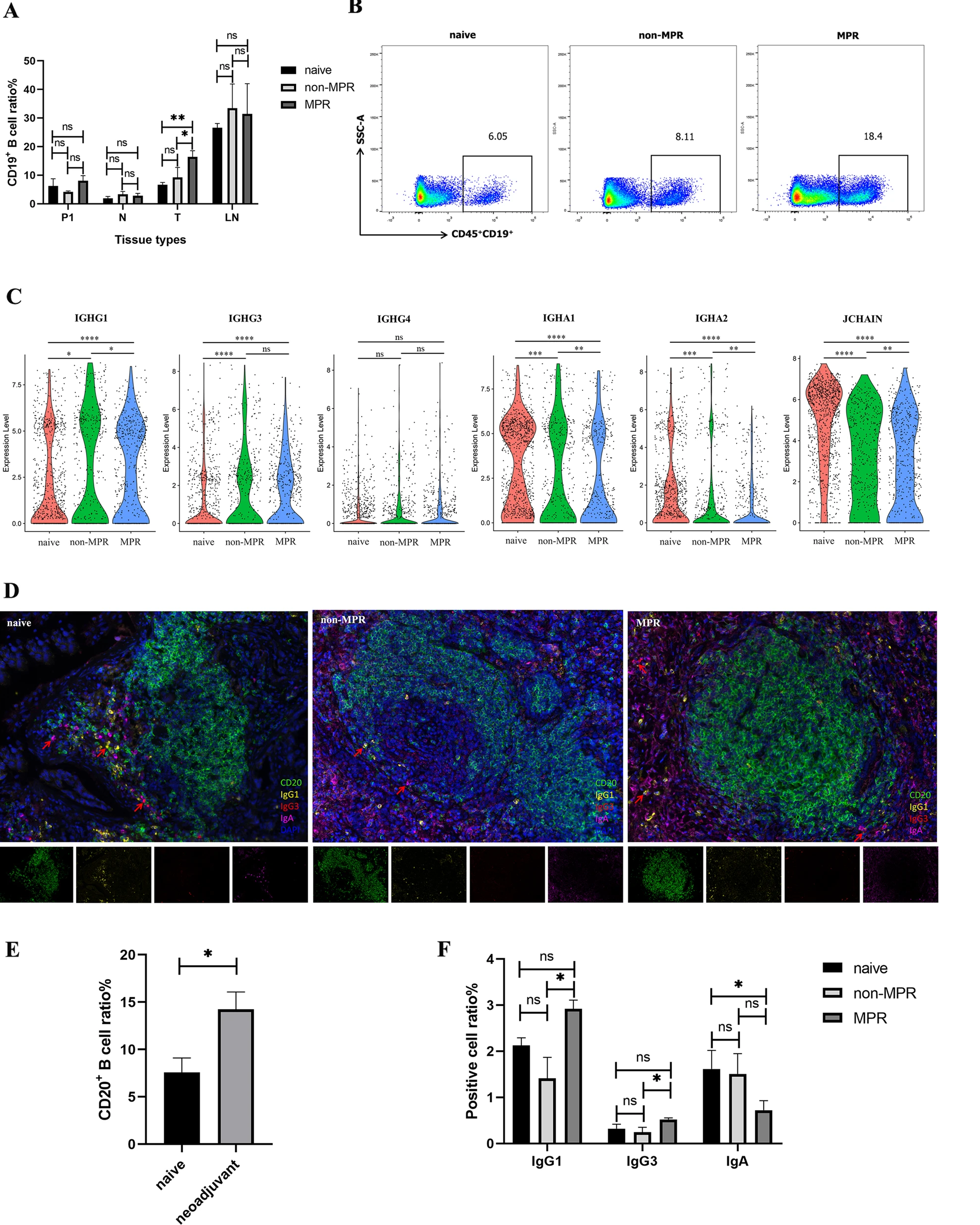 免疫治疗新热点| 新辅助化疗对非小细胞肺癌三级淋巴结构的影响