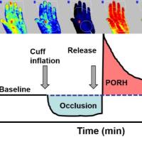 阻断后反应性充血