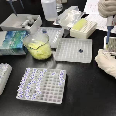 上海晶抗生物:谈谈ELISA检测试剂盒特点与注意事项