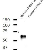 Human Tumor Necrosis Factor Receptor 1 (hTNFR1) TNFR1-5 现货特价