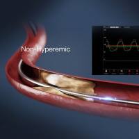 塔望固态压力导管测量仪