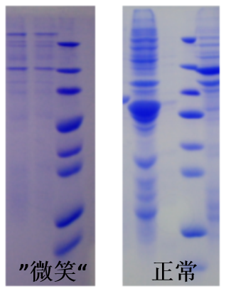 云克隆教你出完美 Western Blot 条带
