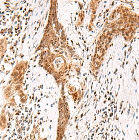 兔抗DGCR6L多克隆抗体