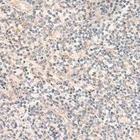 兔抗SYT16多克隆抗体