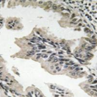 兔抗SH3GLB2多克隆抗体