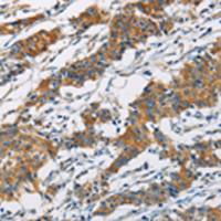 兔抗PIP4K2A多克隆抗体