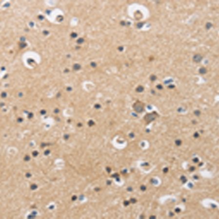 兔抗CKM多克隆抗体