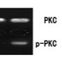 PKC蛋白激酶活性檢測