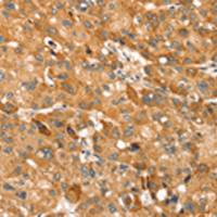 兔抗TRIM62多克隆抗体