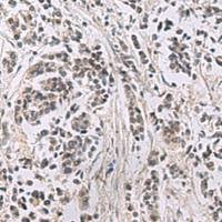 兔抗PPM1K多克隆抗体