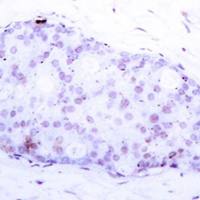 兔抗NFKB1(Phospho-Ser907)多克隆抗体