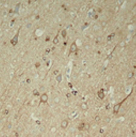 兔抗MAPT(Phospho-Ser396)多克隆抗体