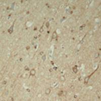 兔抗MAPT(Phospho-Ser396)多克隆抗体