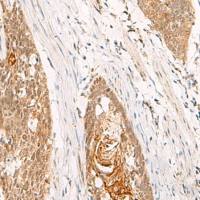 兔抗THNSL1多克隆抗体