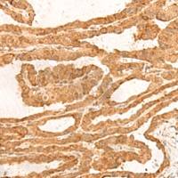 兔抗ZBTB8A多克隆抗体