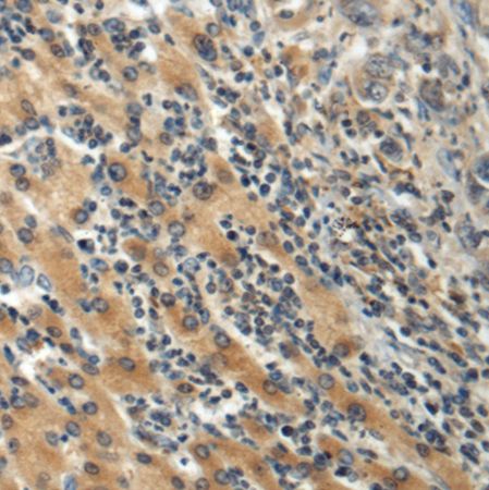 兔抗FBXO11多克隆抗体