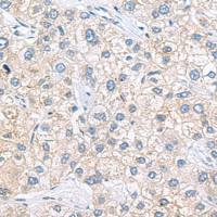 兔抗ZNF35多克隆抗体