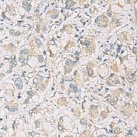 兔抗NLRC4多克隆抗体