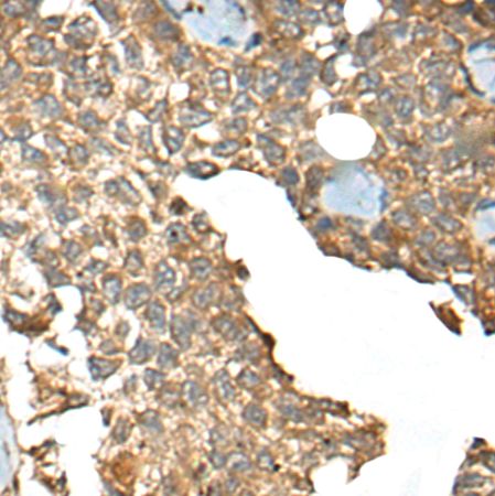 兔抗CCDC113多克隆抗体