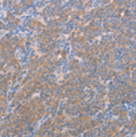 兔抗NFKBIE多克隆抗体