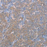 兔抗NFKBIE多克隆抗体