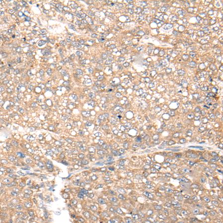 兔抗CDC123多克隆抗体