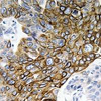 兔抗GJA3多克隆抗体