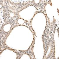 兔抗ZBTB5多克隆抗体