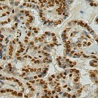 兔抗DCPS多克隆抗体