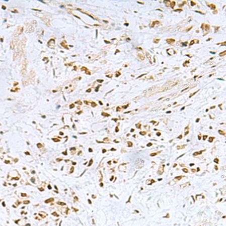 兔抗FOXQ1多克隆抗体