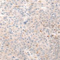 兔抗SOGA1多克隆抗体