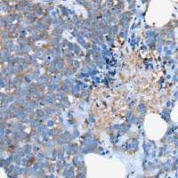 兔抗UGT2B15多克隆抗体