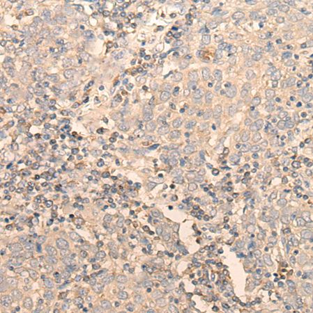 兔抗RPL3多克隆抗体