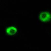 兔抗ARSI多克隆抗体