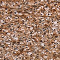 兔抗NOC2L多克隆抗体