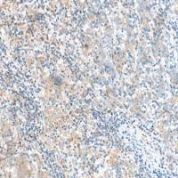 兔抗RMND5A多克隆抗体