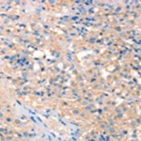 兔抗PRPS1 2 1L1多克隆抗体