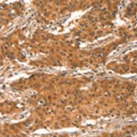 兔抗CHUK多克隆抗体