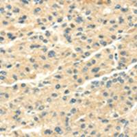 兔抗SNX20多克隆抗体