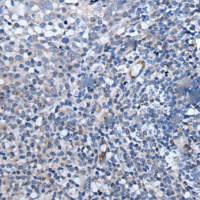 兔抗PAPPA-AS1多克隆抗体