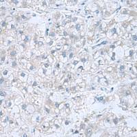 兔抗ATP6V1C1多克隆抗体