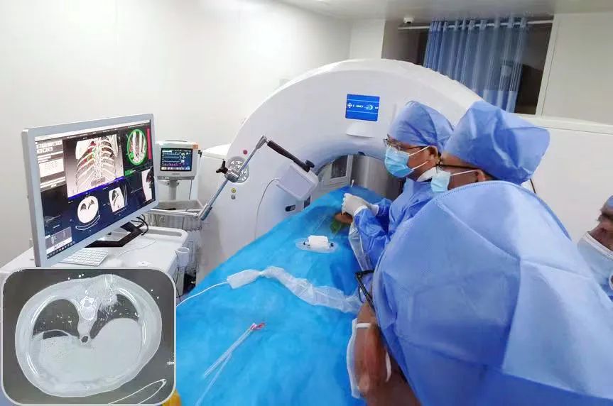 郑州大学第五附属医院率先开展 IQQA-Guide 智能手术导航机器人引导下肿瘤精准粒子植入术